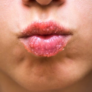 Embrace Luscious Lips with our Organic Lip Scrub: A Must-Have for Dry Lips